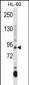 DNMT3A Antibody (CenterR478)